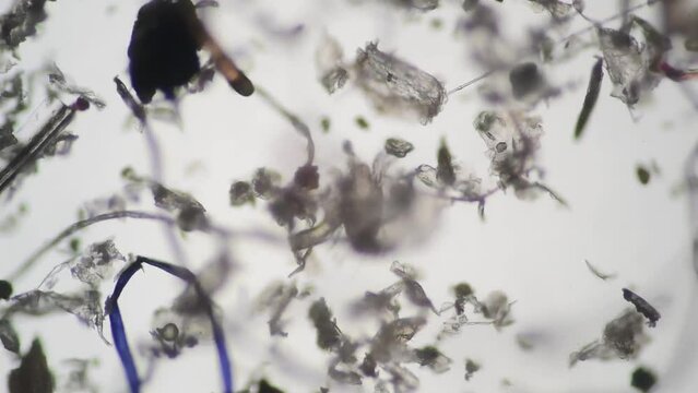 顕微鏡で拡大したハウスダストとダニ