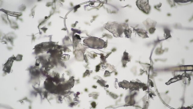 顕微鏡で拡大したハウスダストとダニ