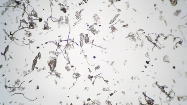 顕微鏡で拡大したハウスダストとダニ