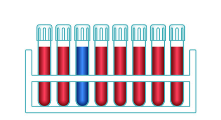 Laboratory test tubes