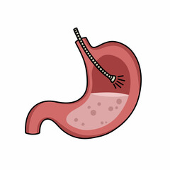 endoscopy doodle icon, vector color line illustration