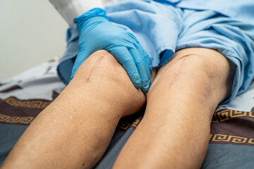 Asian doctor inject Hyaluronic acid platelet rich plasma into the knee of senior woman to walk...