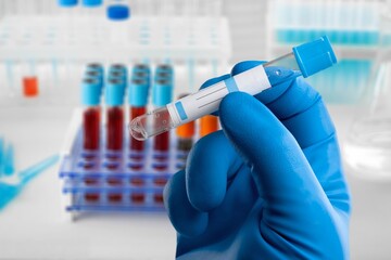 Blood sample of patient for test in laboratory. doctor with Blood tube for Sodium test in lab