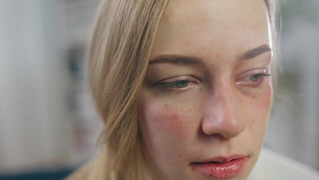 Sad distant woman with bruised face, victim of domestic abuse or aggression
