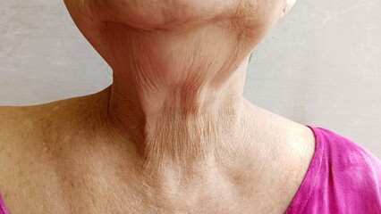 The skin of the neck of the elderly is wrinkled. - obrazy, fototapety, plakaty
