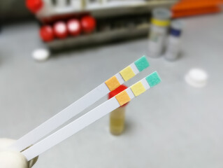 Technician holding two medical strip for urine analysis.