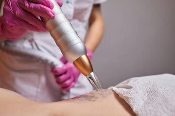 Young woman undergoing laser tattoo removal procedure in salon, closeup.