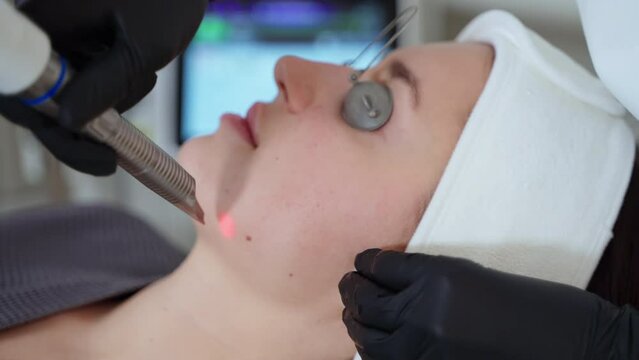 woman is relaxing in cosmetology clinic during laser rejuvenation treatment