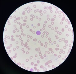 Red blood cells.