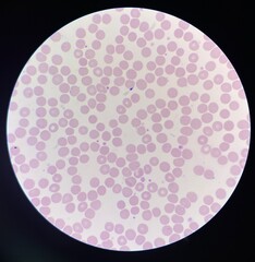 Red blood cells.