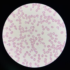 Red blood cells.