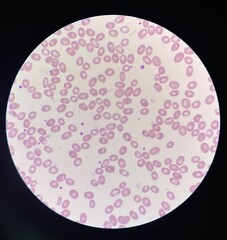 Red blood cells.