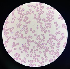 Red blood cells.
