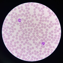 Red blood cells.