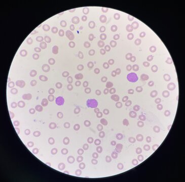 Red blood cells.