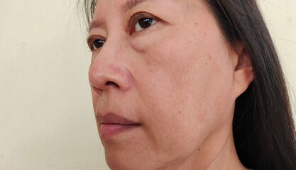 Portrait showing the Flabby and sagging beside the mouth, wrinkles and dark spots, problem blemishes and dullness on the face, ptosis beside the eyelid of the woman, concept health care.