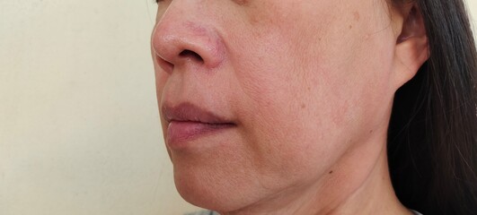 Portrait the wrinkle and Flabby skin, swelling and ptosis beside the eyelid, dark spots and blemish, freckles and scar on the face of the woman, health care and beauty concept.