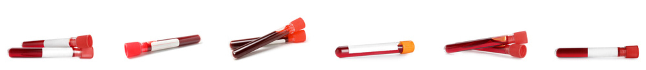 Set of test tubes with blood samples on white background