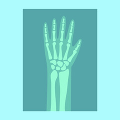X-ray of a hand on a blue background