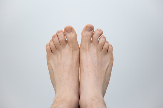 Caucasian male bare feet isolated against white background, Close up front shot, unrecognizable person