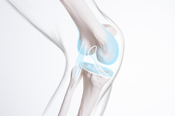 Knee ligament and meniscus, human leg, medically accurate representation of an arthritic knee joint - obrazy, fototapety, plakaty