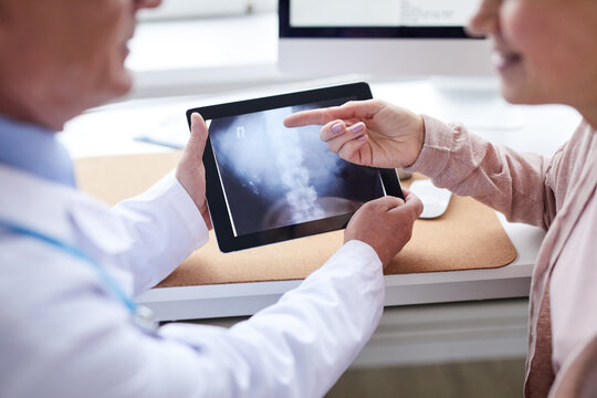 Close-up of female patient pointing at online x-ray image while discussing spinal problem with doctor at appointment