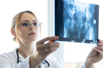 A young doctor examines an X-ray image of a sick patient. Focus on the doctor.