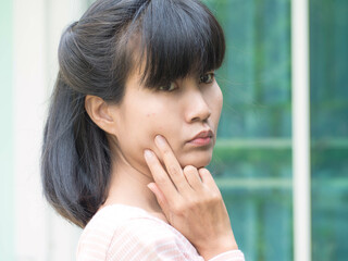 Acne woman. Authentic black hair, black eyes and skin tan asian Thailand. portrait beauty girl show face with little acne. for presentation foam face or lotion cream moisturizer skin care cosmetics.