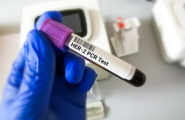 Blood sample for Her-2 or human epidermal growth factor receptor 2 PCR testing for breast cancer...