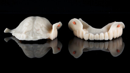 two mock-ups of the prosthesis of two jaws with markers for scanning