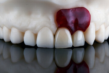 excellent angle on the dental model with two crowns and a fragment of tissue on glass with...