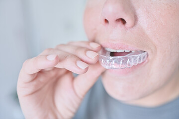 Orthodontic teeth corrector. Woman adjusts an invisible brace made of silicone to her teeth that...