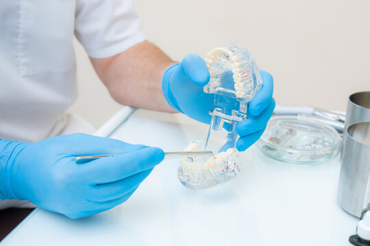 hands of a dentist in blue gloves close-up. dentist with tweezers shows defects on the acrylic model of the jaw