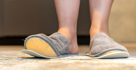  torn slippers.  Women's or girl's in torn house slippers.