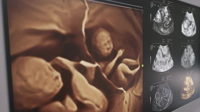Diagnostic prenatal check-up of the pregnant woman at the clinic. Diagnostic check of the foetus health during pregnancy. Diagnostic check found identical twins inside of the pregnant female belly.