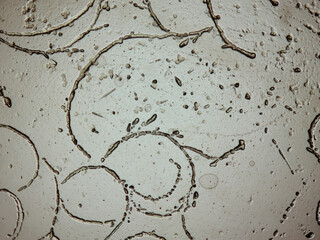 photomicrograph of dermatophytes, skin scraping for fungus test