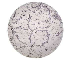 photomicrograph of dermatophytes, skin scraping for fungus test