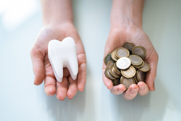 Dental Implant Money