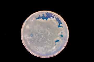 Petri dish with colonies of bacteria in a microbiology laboratory