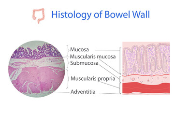 histology of colon wall