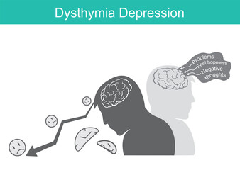 Dysthymia Depression. illustration for psychology in education brain and behaviour a patient depression..