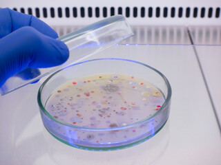 The scientist opened the lid of the Petri dish and showed colonies of bacteria, close-up