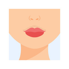 Unwanted Facial Hair. Female Mustache above the Upper Lip. Front view. Hormonal Disbalance. Color Cartoon style. White background. Vector illustration for Medical and Beauty Design.