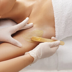Beautician is removing hair from young female armpits with hot wax. Girl has a beauty treatment...