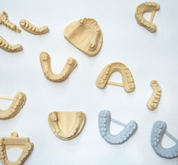 lower jaw of a man created on a 3d printer