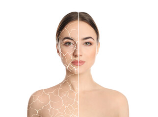 Collage with photos of woman having dry skin problem before and after dry skin problem on white...