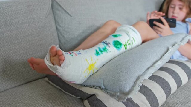 Young Caucasian Girl Resting on Couch Scratching Itchy Skin on Injured Broken Bone Leg Stabilized with Orthopedic Cast Plaster Shell