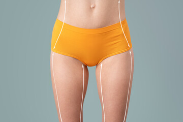Hip, abdomen liposuction, fat and cellulite removal concept, female body with painted surgical lines