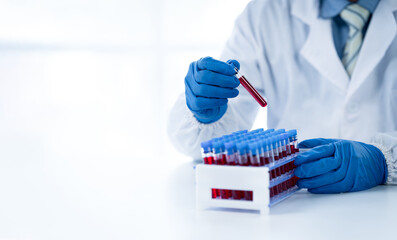 Doctor hand taking a blood sample tube from a rack with machines of analysis in the lab background, Technician holding blood tube test in the research laboratory. © PaeGAG