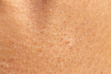 allergic rash on the skin as a background - obrazy, fototapety, plakaty